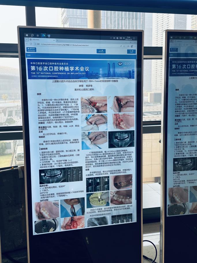 科普展演出彩，多篇壁报入选  重庆松山医院口腔科闪耀全国第 16 次口腔种植年会