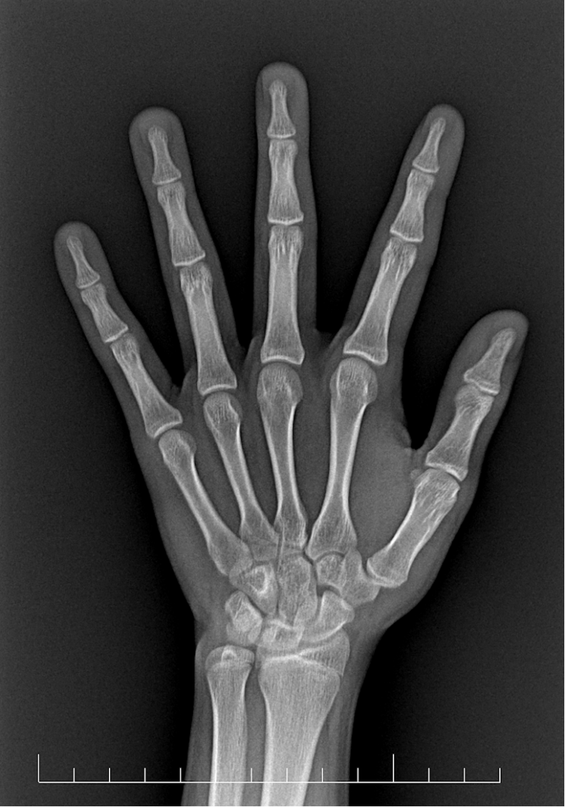 别再只量身高了!这个数字,才是孩子长高的关键密码