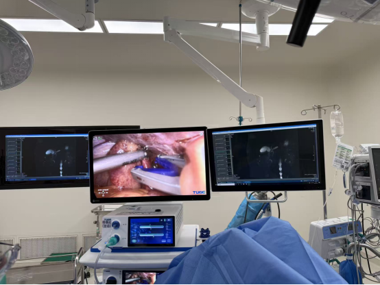 昆明三博普外科团队勇攀腹部外科手术「珠峰」,成功实施胰十二指肠切除术