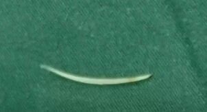 「吃鱼高手」栽在鱼刺上!卡喉后做对这 3 步,速看→