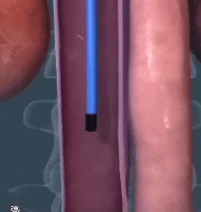 救命的工具,怎就成了埋下的雷?