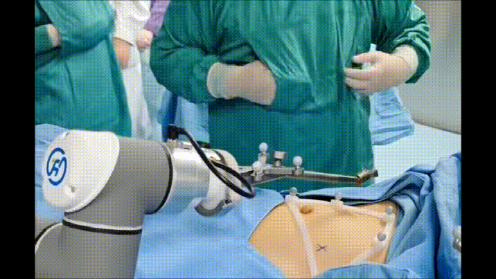 人工智能机器人「一针到位」消融肺结节!广西医科大一附院心胸外科再突破