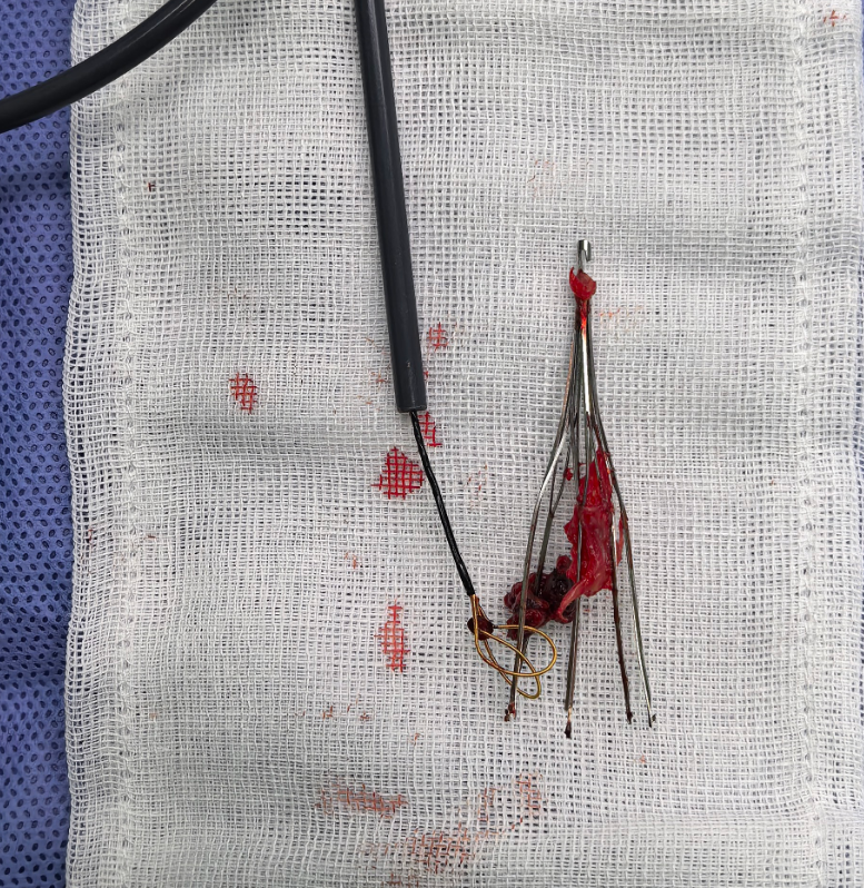 救命的工具,怎就成了埋下的雷?