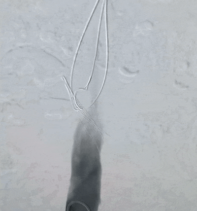 救命的工具,怎就成了埋下的雷?