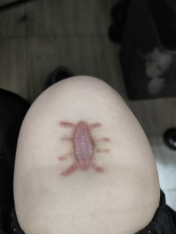 疤痕烦恼？试试这款特殊的「创可贴」！