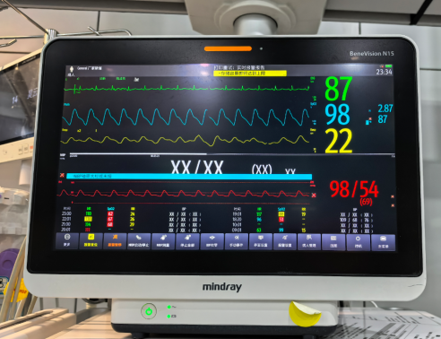 生死关头，ECMO 力挽狂澜！黔江中心医院重症医学科成功救治极危重「白肺」患者！