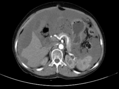 隐秘的健康警报，两例特殊病例揭示诊治关键