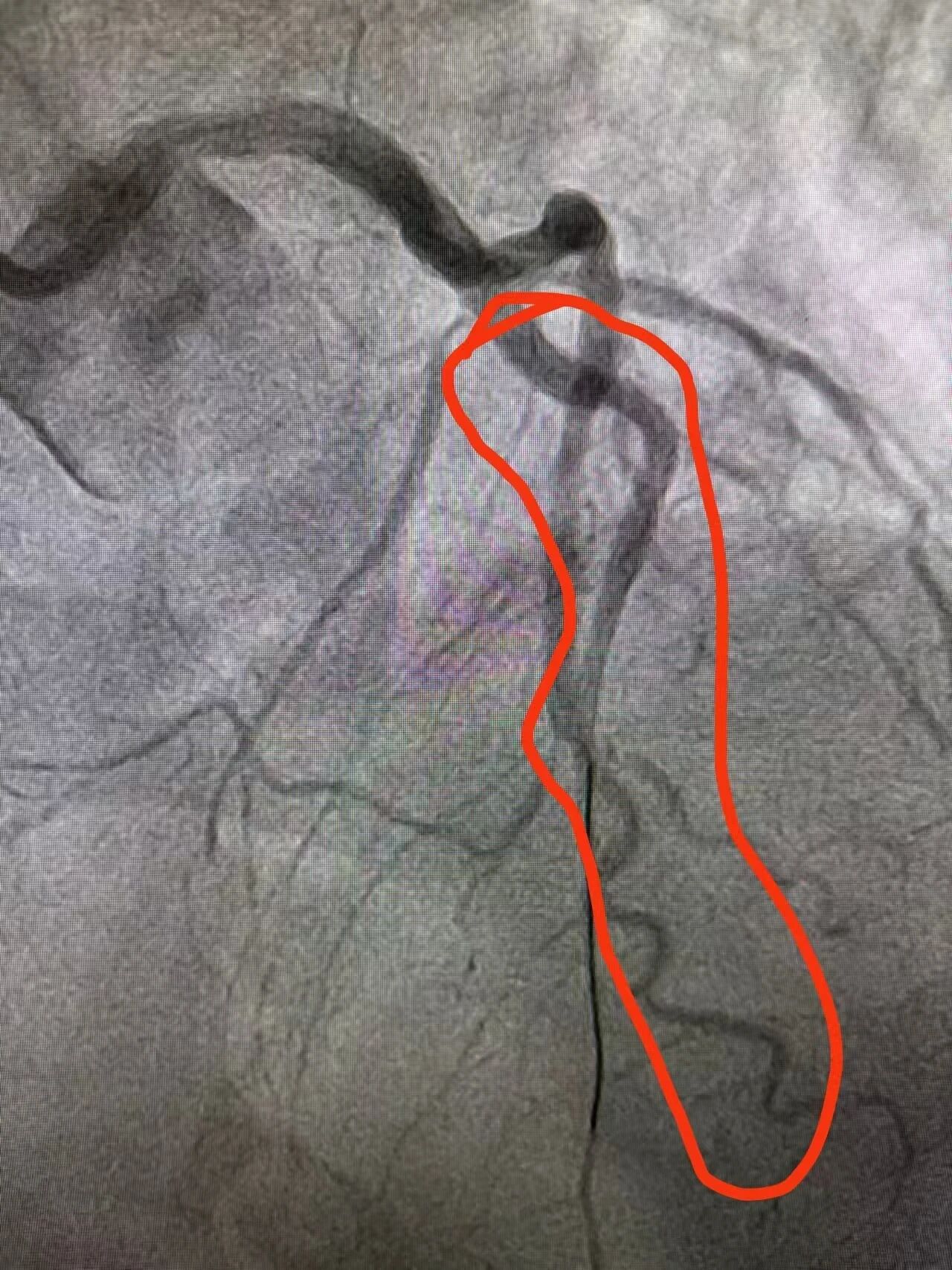布局革新！南京江北医院心脏中心 10 米 「生命通道」，为心梗患者抢赢黄金时间