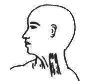 脖子痛、歪向一边？出现「歪脖子」别大意，当心患上痉挛性斜颈！