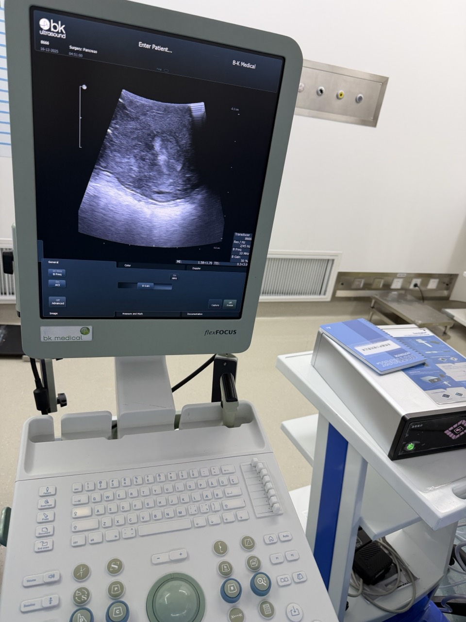 为手术刀装上「实时导航」：当术中超声成为妇科医生的「第二双眼」