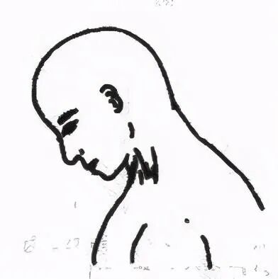 脖子痛、歪向一边？出现「歪脖子」别大意，当心患上痉挛性斜颈！