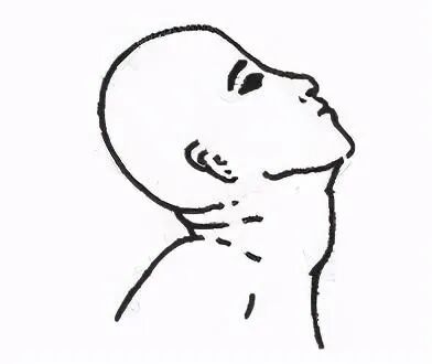 脖子痛、歪向一边？出现「歪脖子」别大意，当心患上痉挛性斜颈！