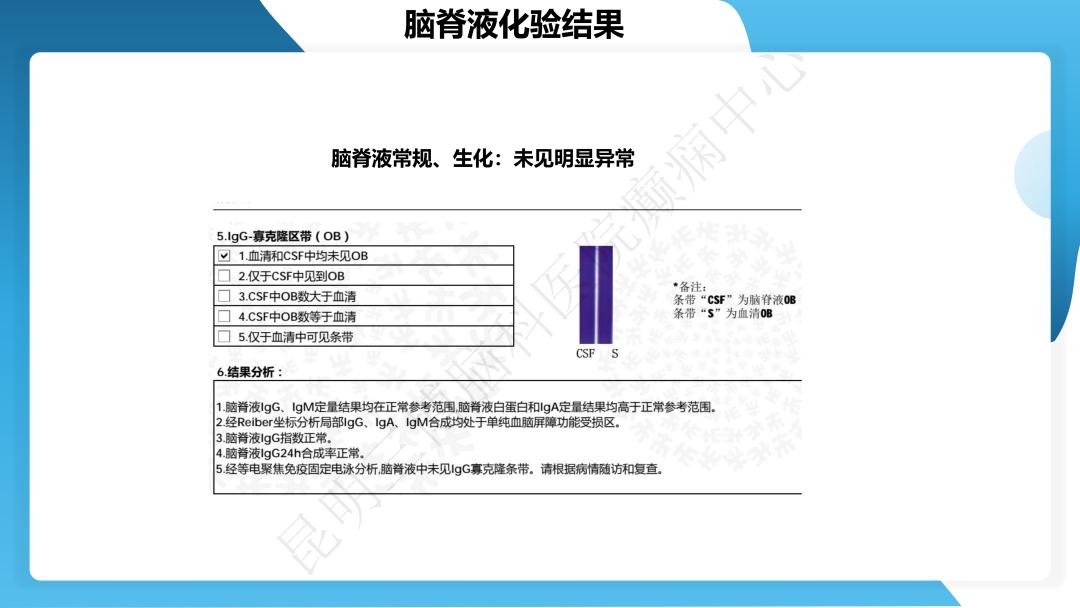 治疗抗 LGI1 抗体相关自身免疫性脑炎继发癫痫一例