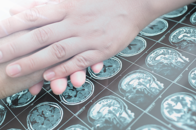 什么原因让癫痫变得「难治」？久治不愈的患者该怎么治疗？