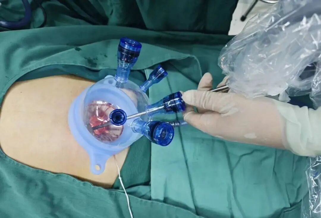 肚脐眼隐藏着这个功能…