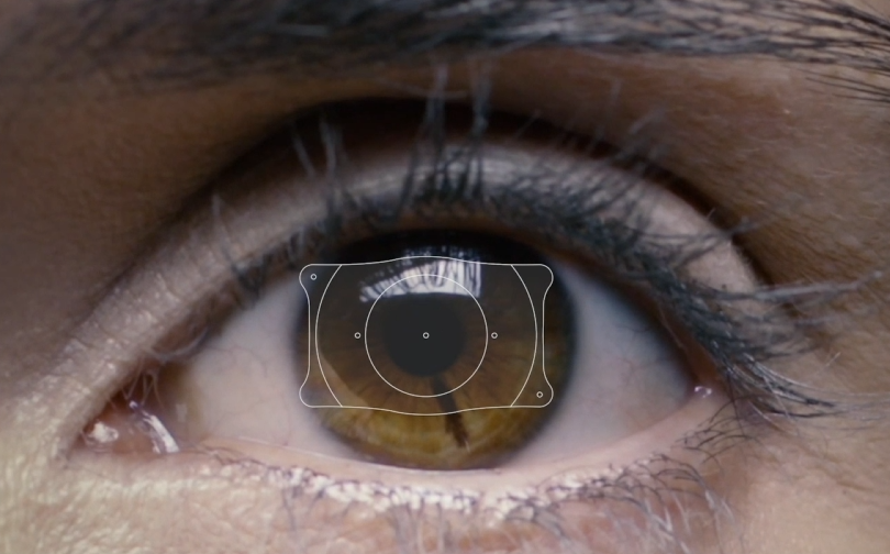 近视手术术前报告怎么看?关键是这几个指标