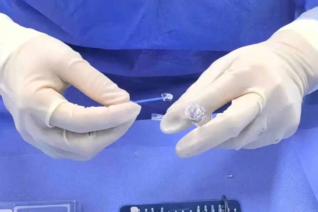 全国首批!杭州华厦眼科黄旭院长成功实施 ICL(V5) 晶体植入术!