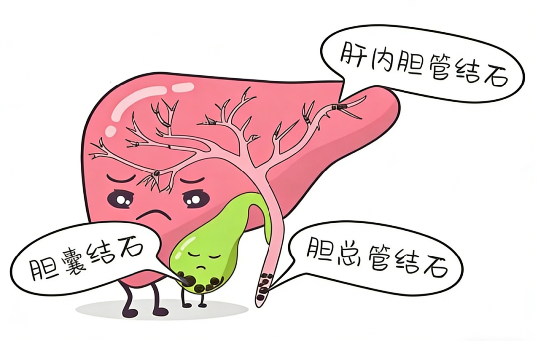 100 多颗！66 岁老人体内密密麻麻，塞满了···医生紧急提醒！