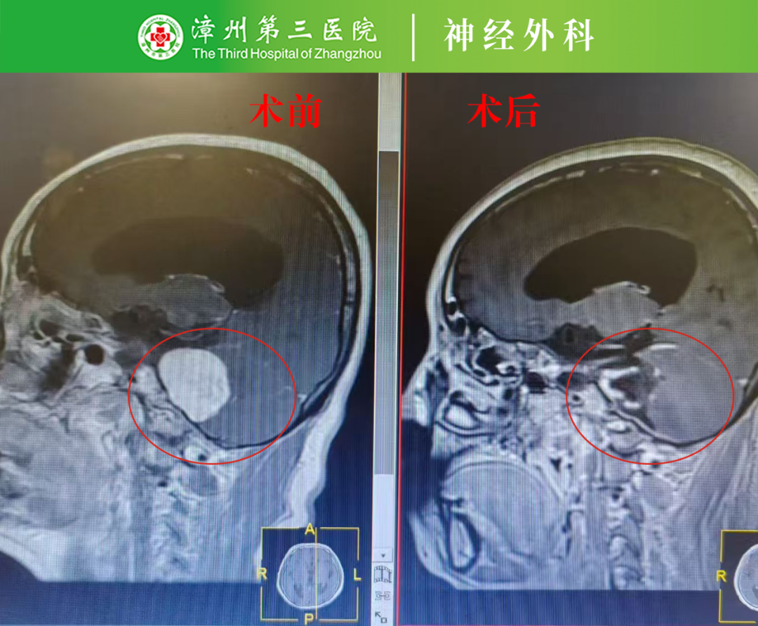 不可能中的可能