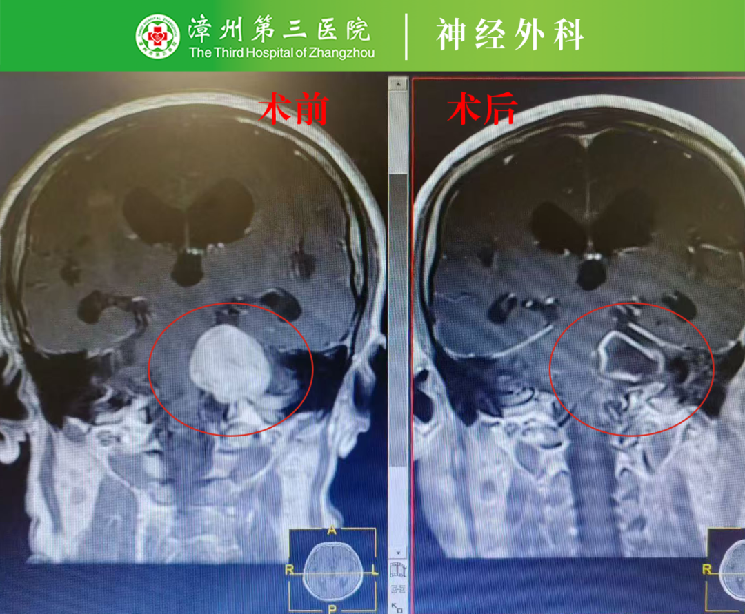 不可能中的可能