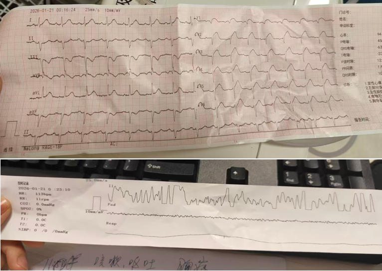 深夜惊魂！心梗室颤反复发作，昆明三博多学科竞速救回 63 岁老人