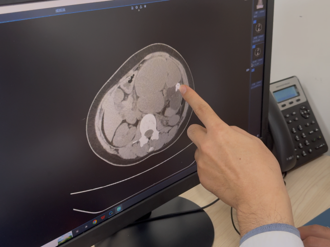 「我肚子里，长了一颗牙」