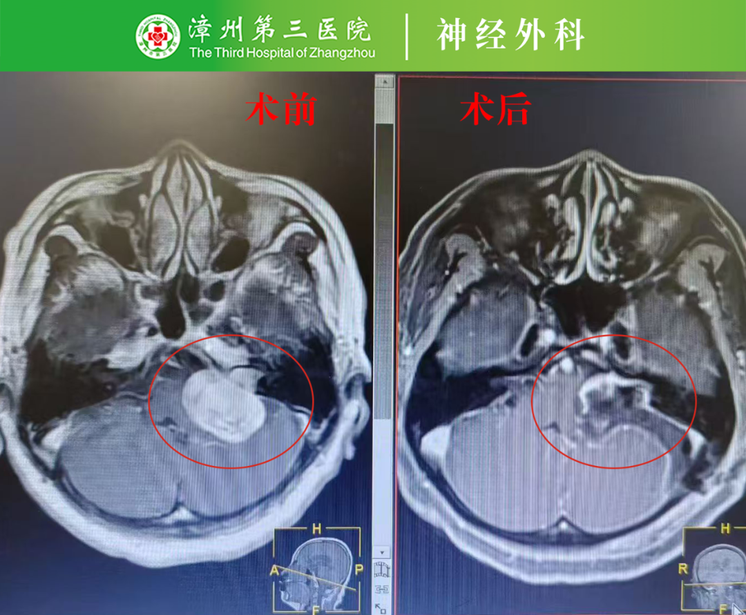 不可能中的可能