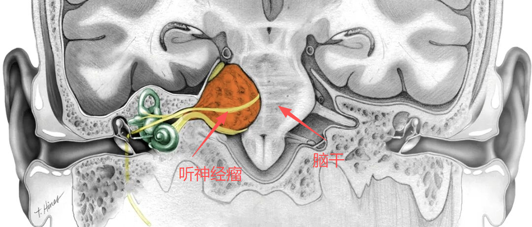 不可能中的可能