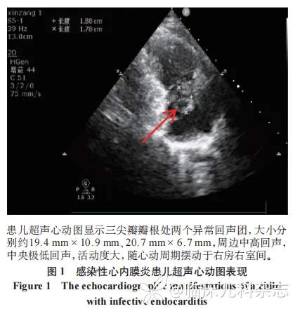 肺炎支原体肺炎继发儿童感染性心内膜炎临床特征与诊治分析