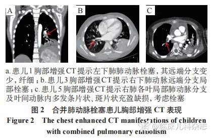 肺炎支原体肺炎继发儿童感染性心内膜炎临床特征与诊治分析