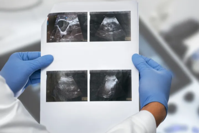 体检发现「它」？诱因可能藏在你的早餐里！没有药物能治疗，只有手术「切或留」