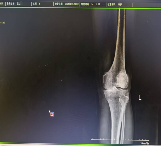 膝盖针扎样的疼，不敢走路，怎么回事？