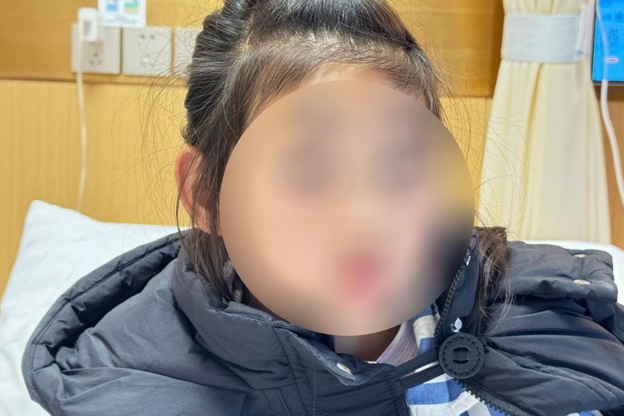 7 岁女童歪头视物背后藏隐情,眼科手术助其缓解眼球震颤困扰