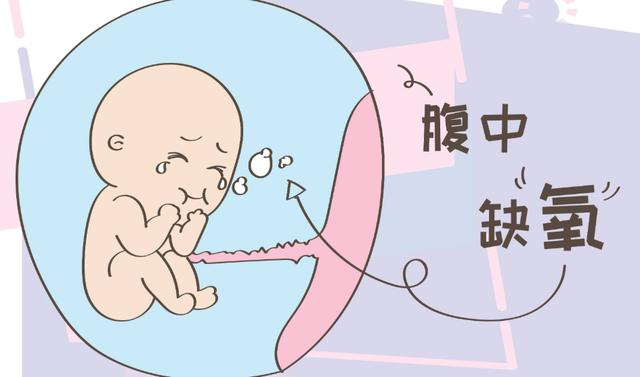 凌晨突发胎儿窘迫，晚一步宝宝性命堪忧！杨御华主任 32 分钟极速救援，母婴平安