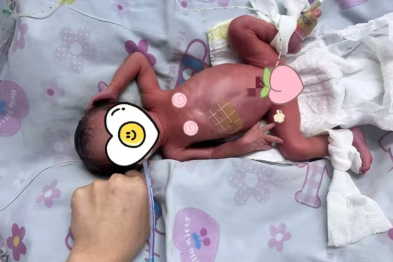 1 kg→2.23 kg：一场关于爱与专业的生命「逆袭」！
