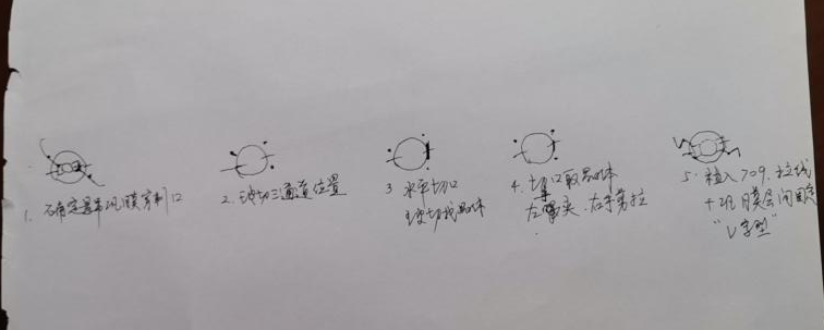 巴西高管「三战」眼疾,常州谱瑞眼科医院托起清晰视界