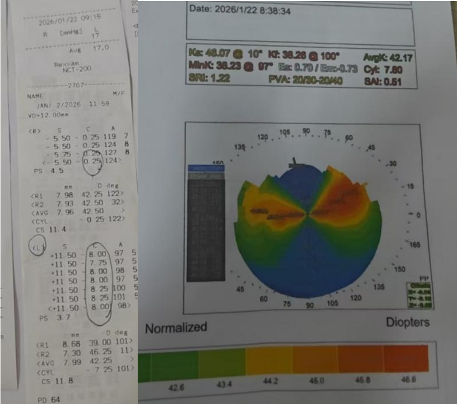 巴西高管「三战」眼疾,常州谱瑞眼科医院托起清晰视界