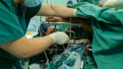 1.2 米钢筋,整体贯穿六旬老妇身体!武汉大学人民医院多学科全力以赴,奇迹般救活她