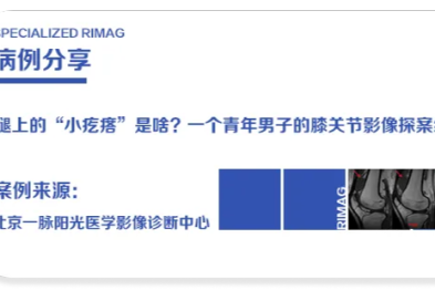 典型病例  |  腿上的「小疙瘩」是啥？一个青年男子的膝关节影像探案纪实