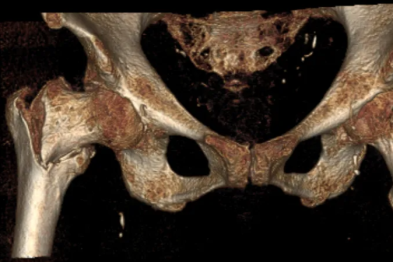 精湛技术托起银龄人生，暖心照护谱写和谐篇章