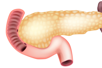 避免 6 器官损伤，合肥京东方医院消化内科微创切除十二指肠罕见肿瘤