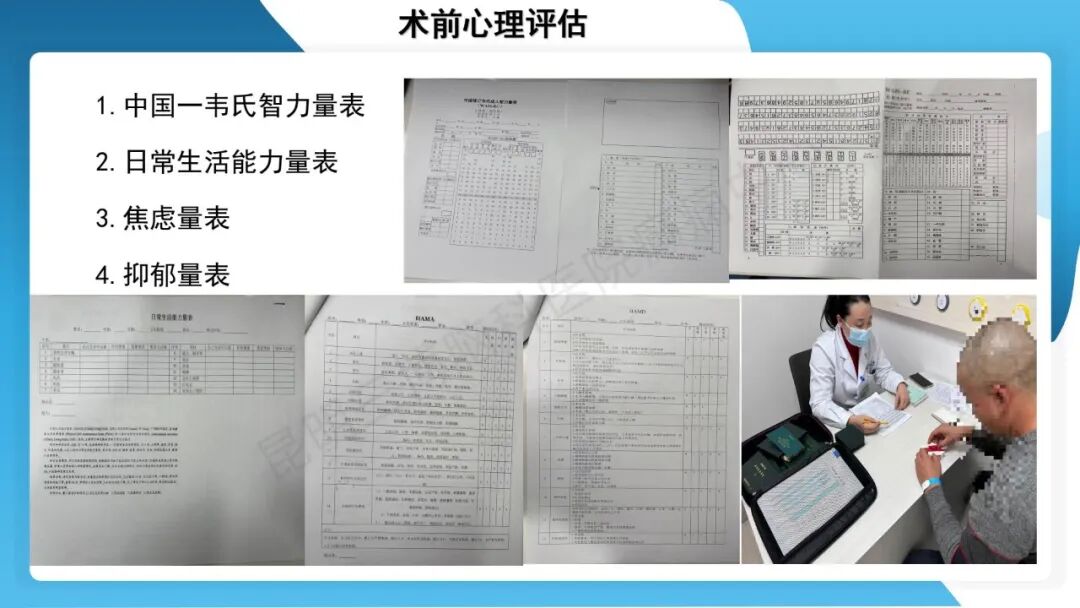癫痫患者术前准备