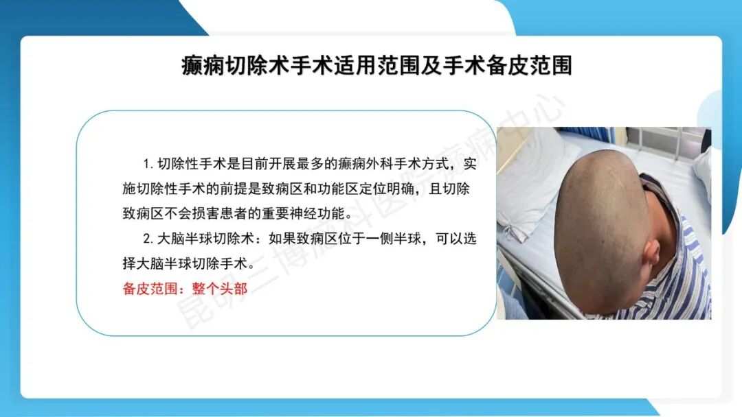 癫痫患者术前准备