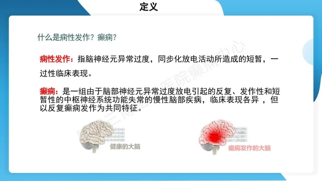 癫痫患者术前准备