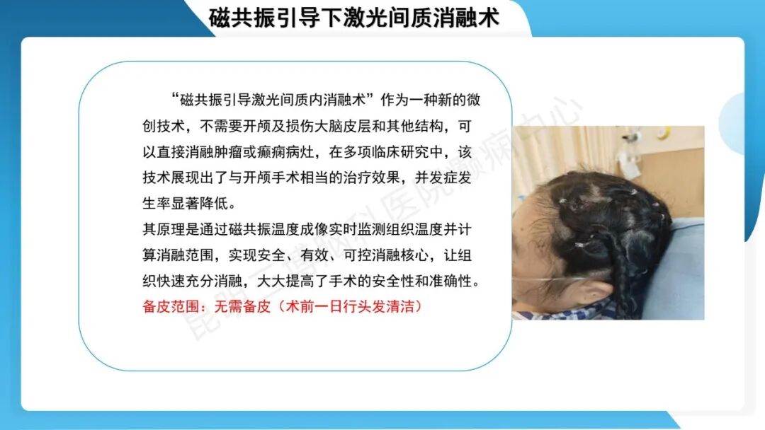 癫痫患者术前准备