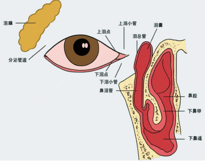 流泪流脓久不愈？警惕泪小管炎！