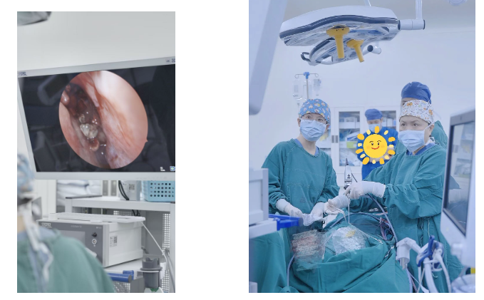 间断头痛伴脓涕两年，蝶窦里竟藏着「致命真菌团」！58 岁先生到底得了什么病？