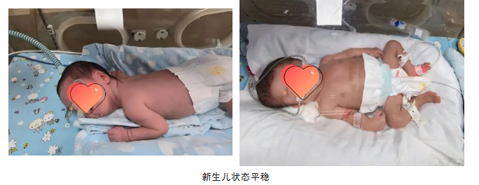 23 年狼疮病史+尿毒症+妊娠！交大一附院突破生命禁区护航高危产妇安全分娩