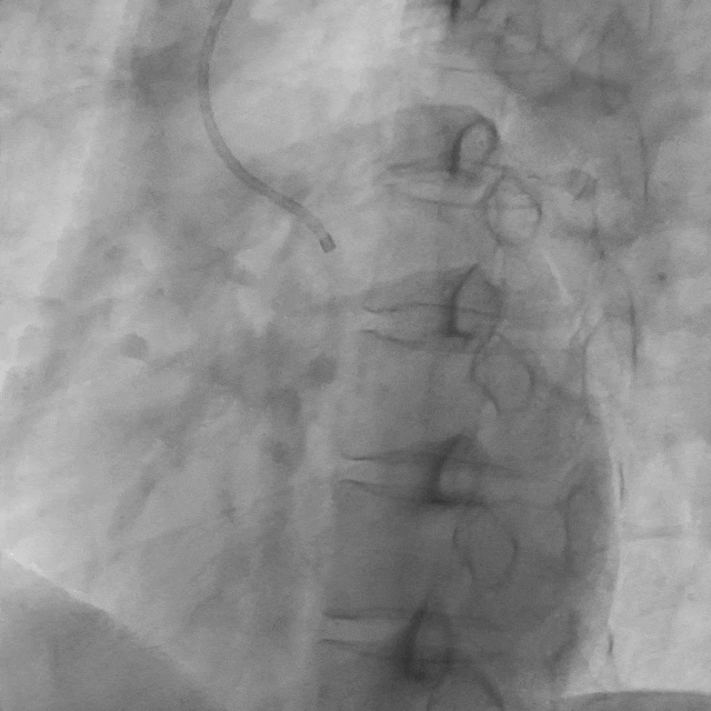坐车时突然眼前一黑,是太累了还是心脏在「求救」?|一场「晕厥」的迷雾