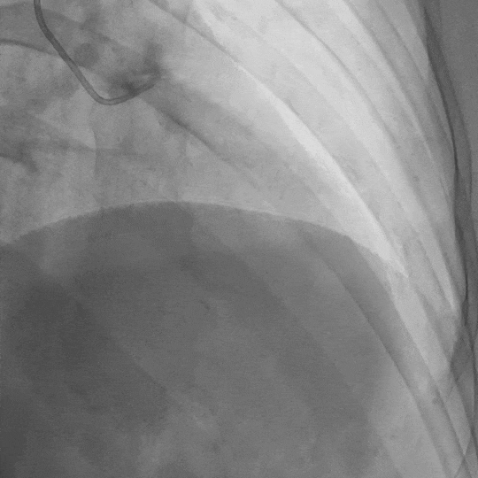 坐车时突然眼前一黑,是太累了还是心脏在「求救」?|一场「晕厥」的迷雾
